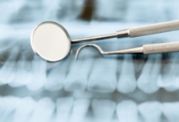 img-computer-for-dental